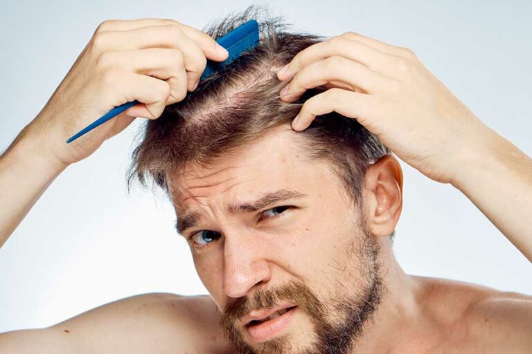 Haarausfall nach Haartransplantation? First Hair Clinic