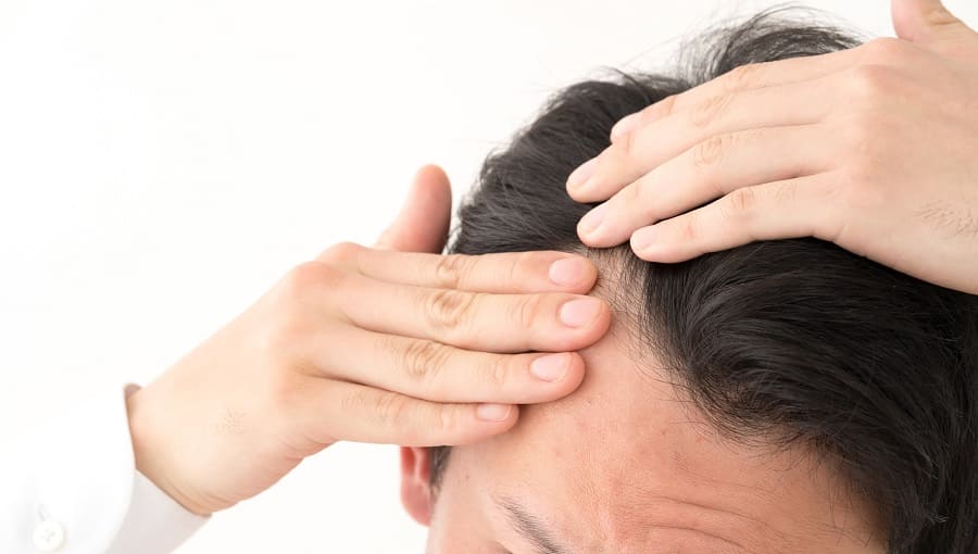 Beweggrund für eine Haartransplantation - Auswirkungen des Haarausfalls