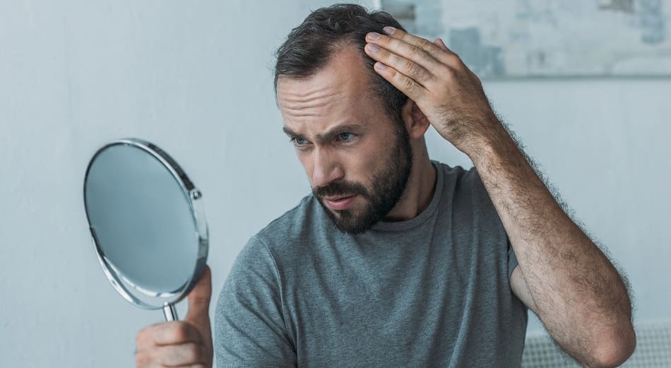 Haarausfall bei Diabetes - Junge Mann schaut sein Geheimratsecken
