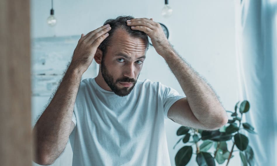 In manchen Fällen hilft Folsäure gegen Haarausfall Mann begutachtet seinen Haarausfall im Spiegel