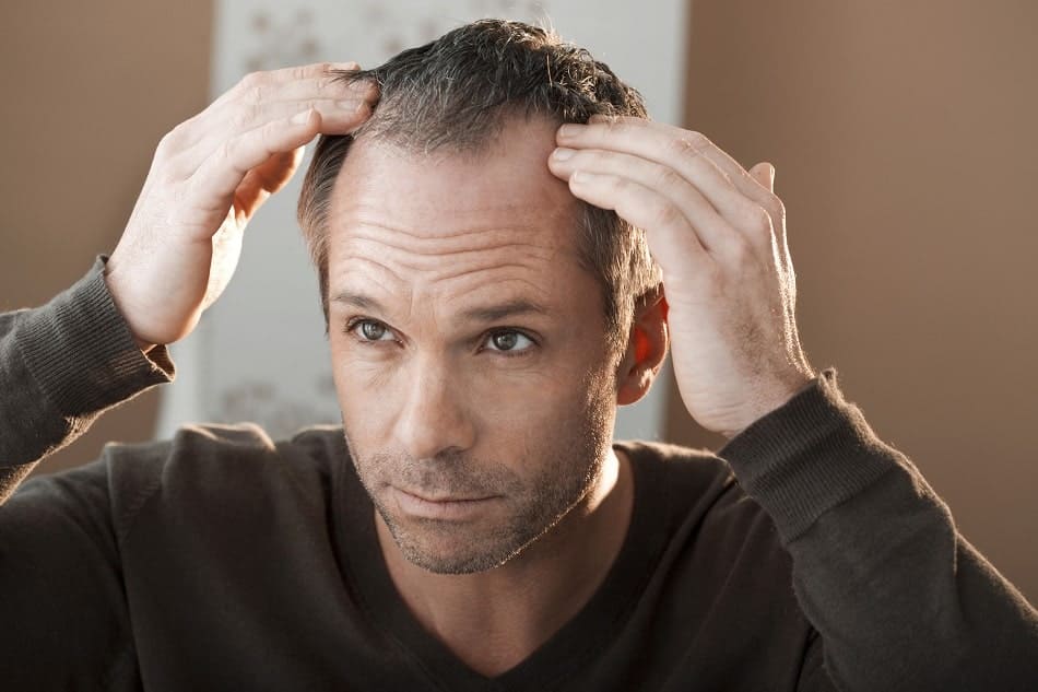 Mann mit Haarausfall fasst sich an die Geheimratsecken