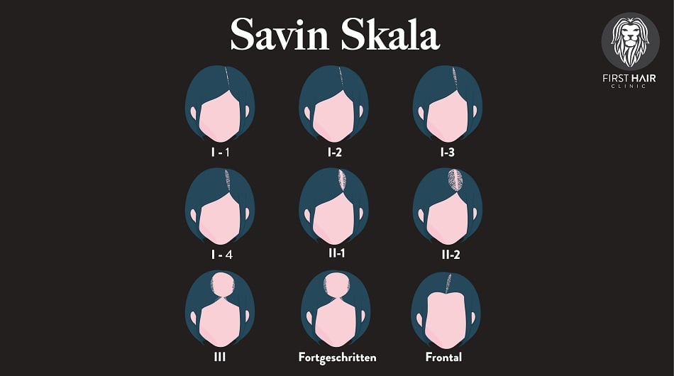 Darstellung der Savin Skala