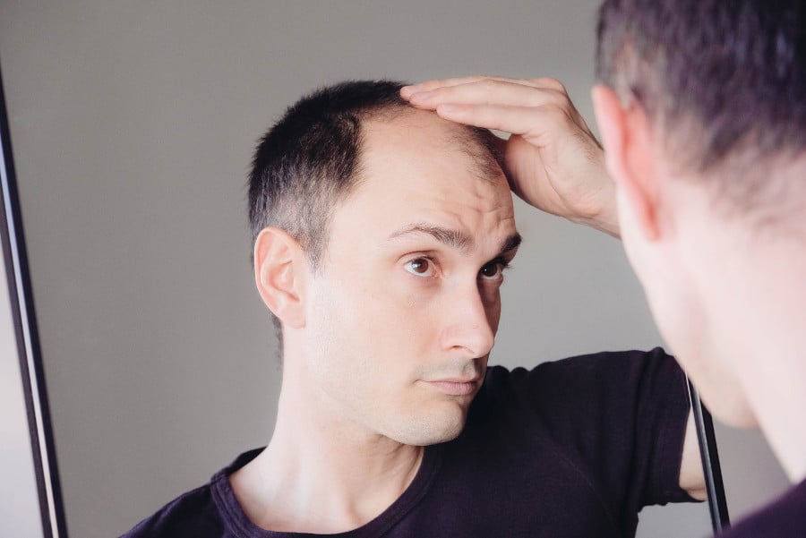 Mann fragt sich ob Haarausfall rückgängig gemacht werden kann