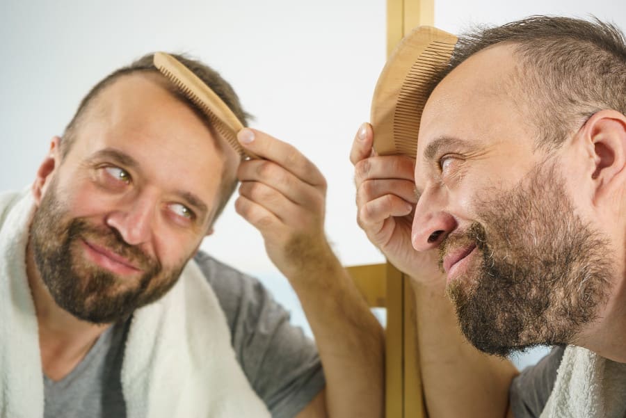 Mann kämmt sich die Haare und fragt sich nach dem richtigen Verhalten nach einer Haartransplantation