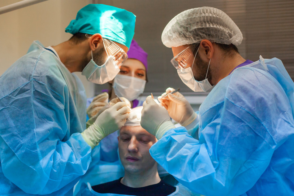 Spezialisten führen eine Haartransplantation bei Vollglatze durch