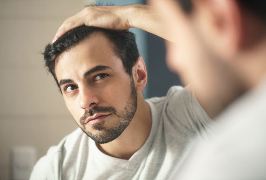 Mann mit Geheimratsecken denkt über Haartransplantation ohne Rasur nach