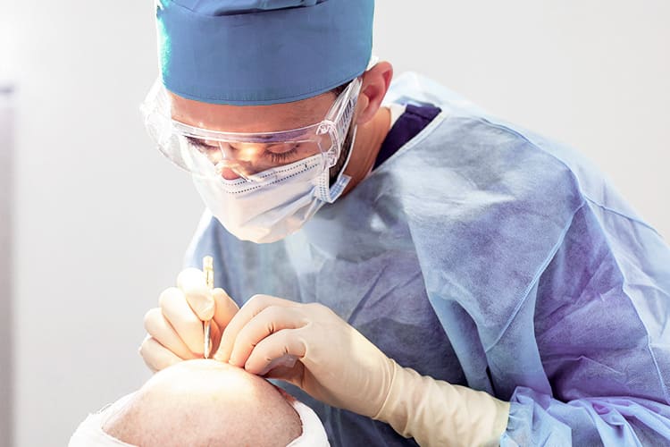 Arzt führt bei Patienten die DHI Haartransplantation durch