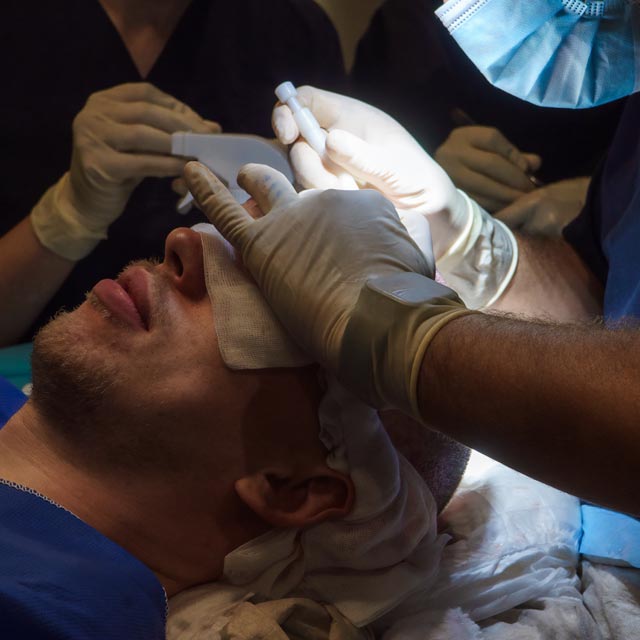 Haartransplantation Arzt mit männlichen Patienten bei der OP