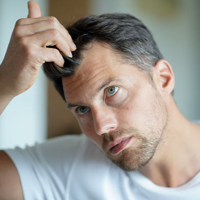 Mann greift sich in die Haare, um den Status der Haartransplantation Heilung zu prüfen
